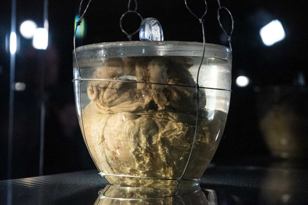 Coração de Dom Pedro I do Brasil exposto na igreja da Lapa no Porto - Voz Portucalense